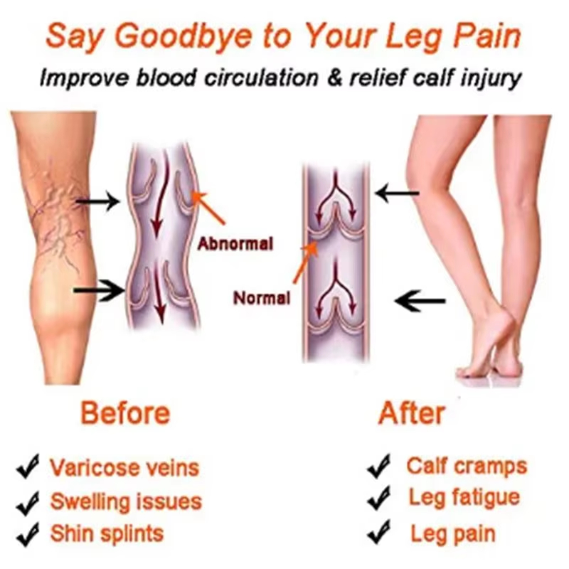 جوارب ضاغطة للنساء والرجال للر - مراجعة Echinacea وسعره